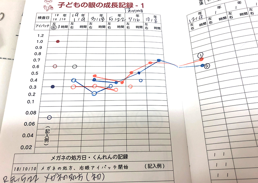 眼科診療｜視力グラフ
